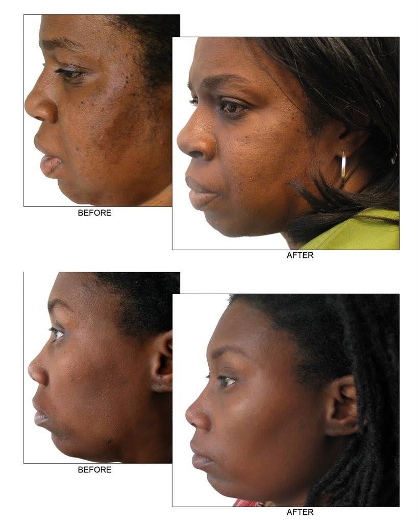 Skincare Enlighten Skin Essentials For Uneven Skintone