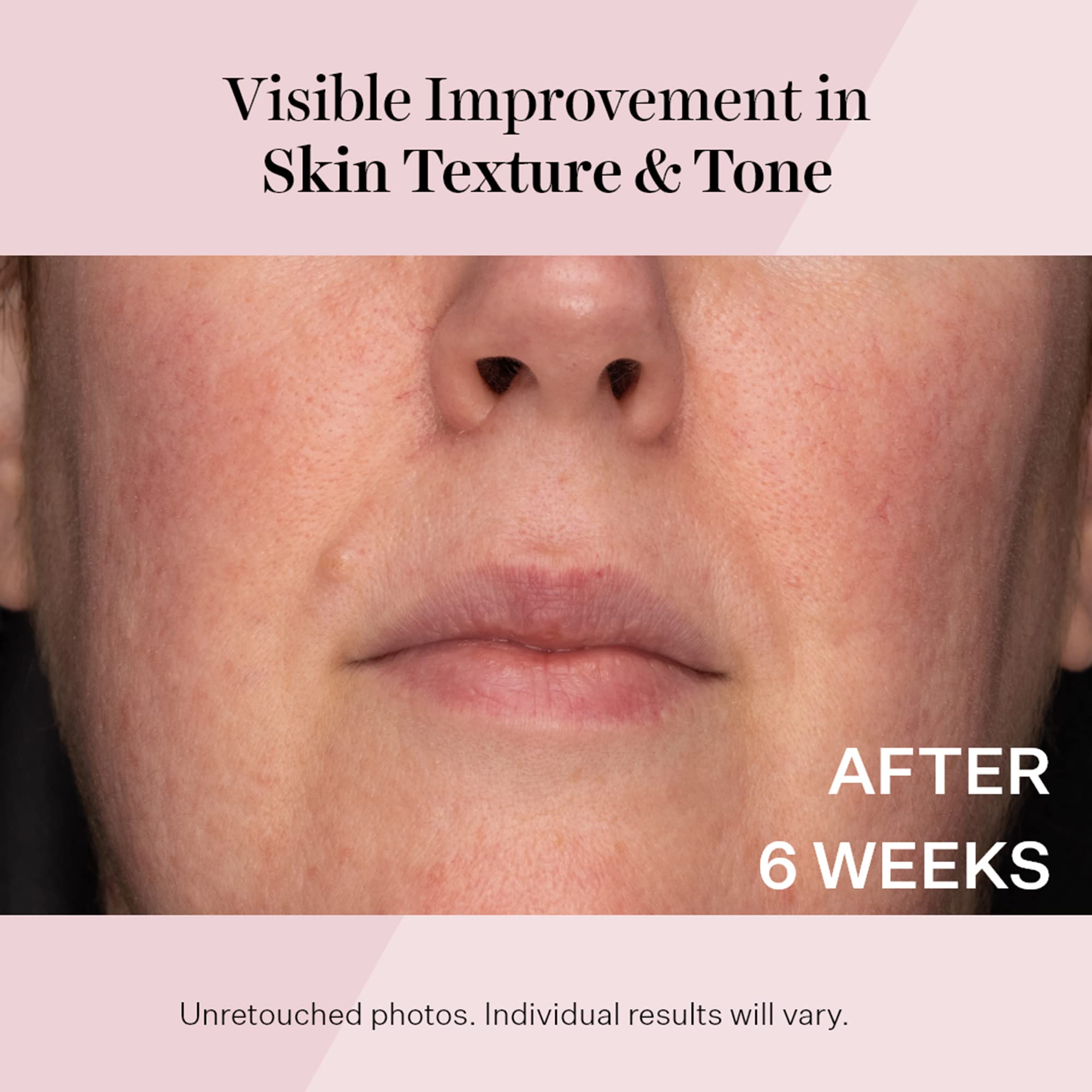 StriVectin Advanced Retinol Intensive Night Moisturizer, Targets Visible Signs of Aging for Healthier Skin, 1.7 Fl Oz