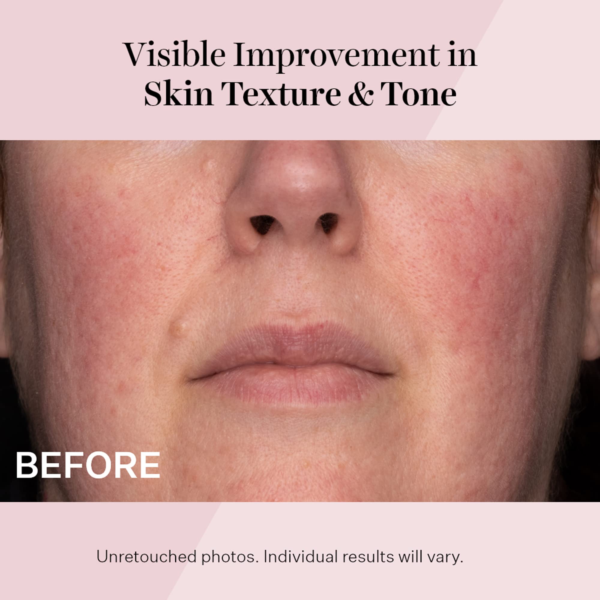 StriVectin Advanced Retinol Intensive Night Moisturizer, Targets Visible Signs of Aging for Healthier Skin, 1.7 Fl Oz