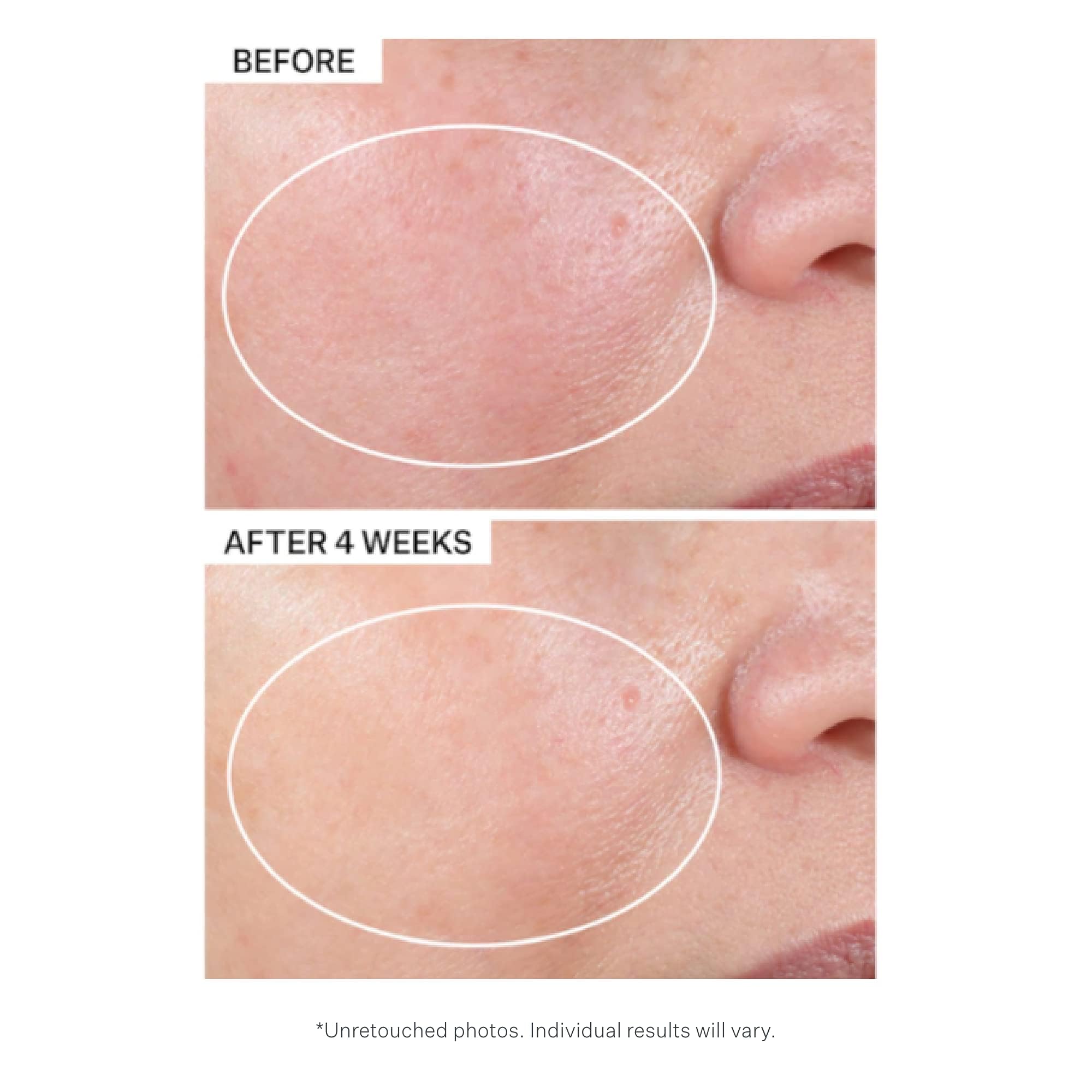 StriVectin Advanced Retinol Intensive Night Moisturizer, Targets Visible Signs of Aging for Healthier Skin, 1.7 Fl Oz