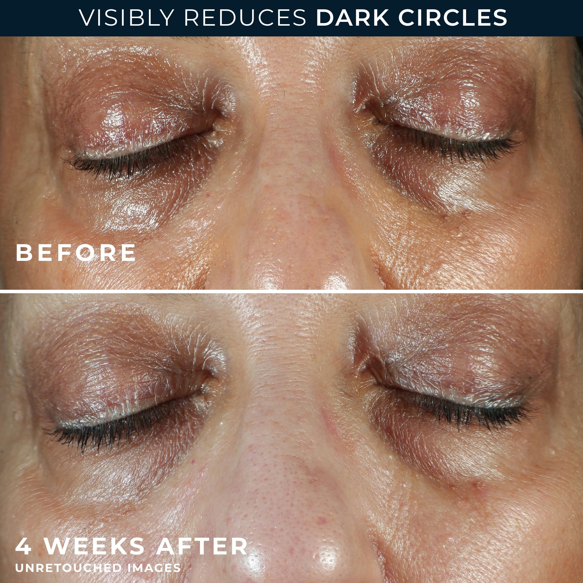 RoC Multi Correxion 5 in 1 Anti-Aging Eye Cream for Puffiness, Under Eye Bags & Dark Circles, Skin Care Treatment with Shea Butter, (.5 oz) with Night Cream Packette (Packaging May Vary)