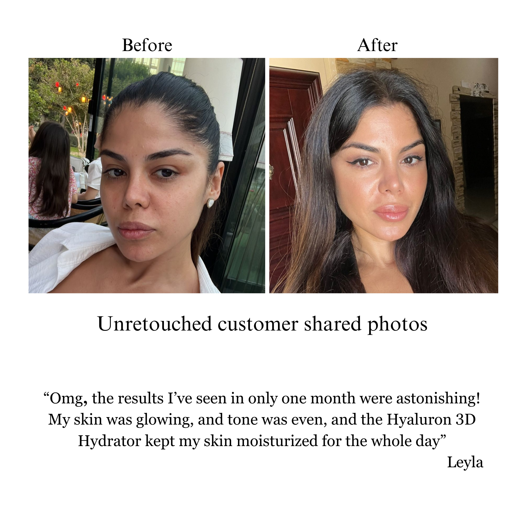 Hyaluron 3D Hydrator Multi Lamellar Emulsion The Advanced Response Face and Neck Cream-Serum