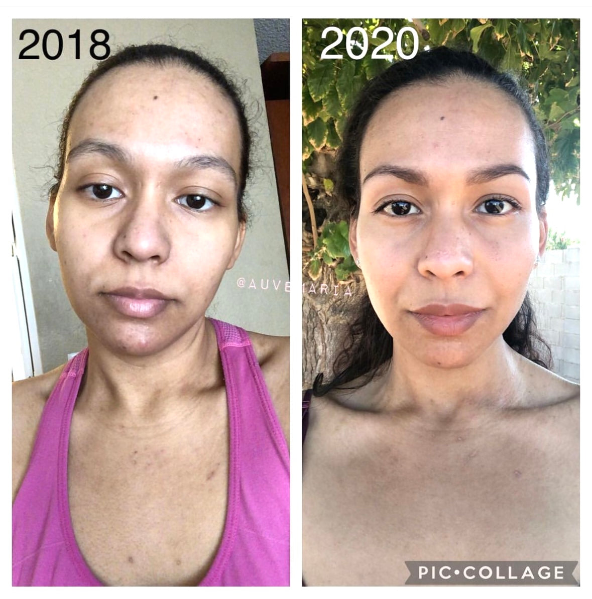 Daily Antioxidant Beauty Tea by Auvê® Beauty