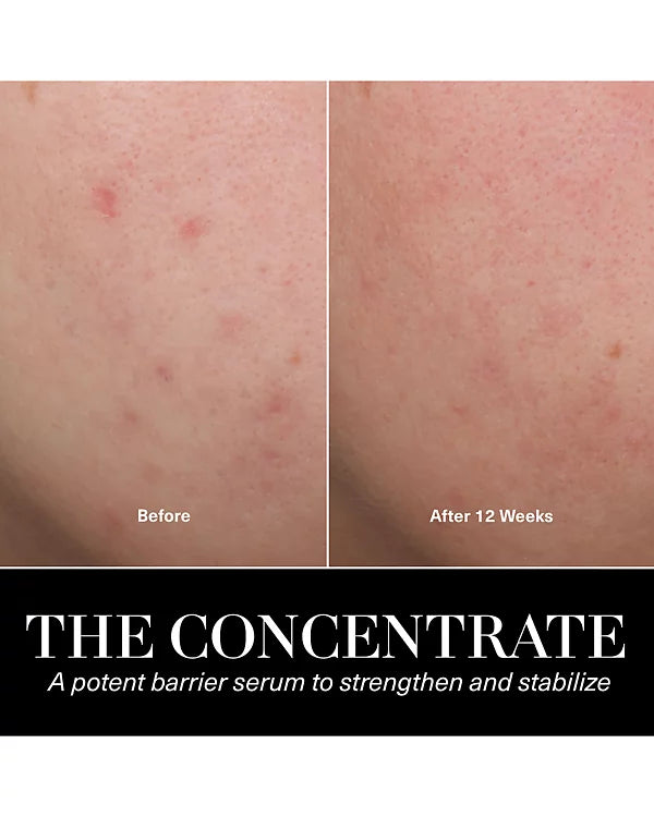 La Mer The Concentrate 1 oz