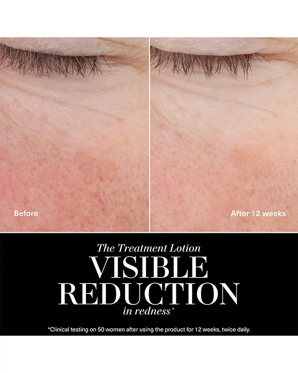 La Mer The Treatment Lotion 6.8 oz