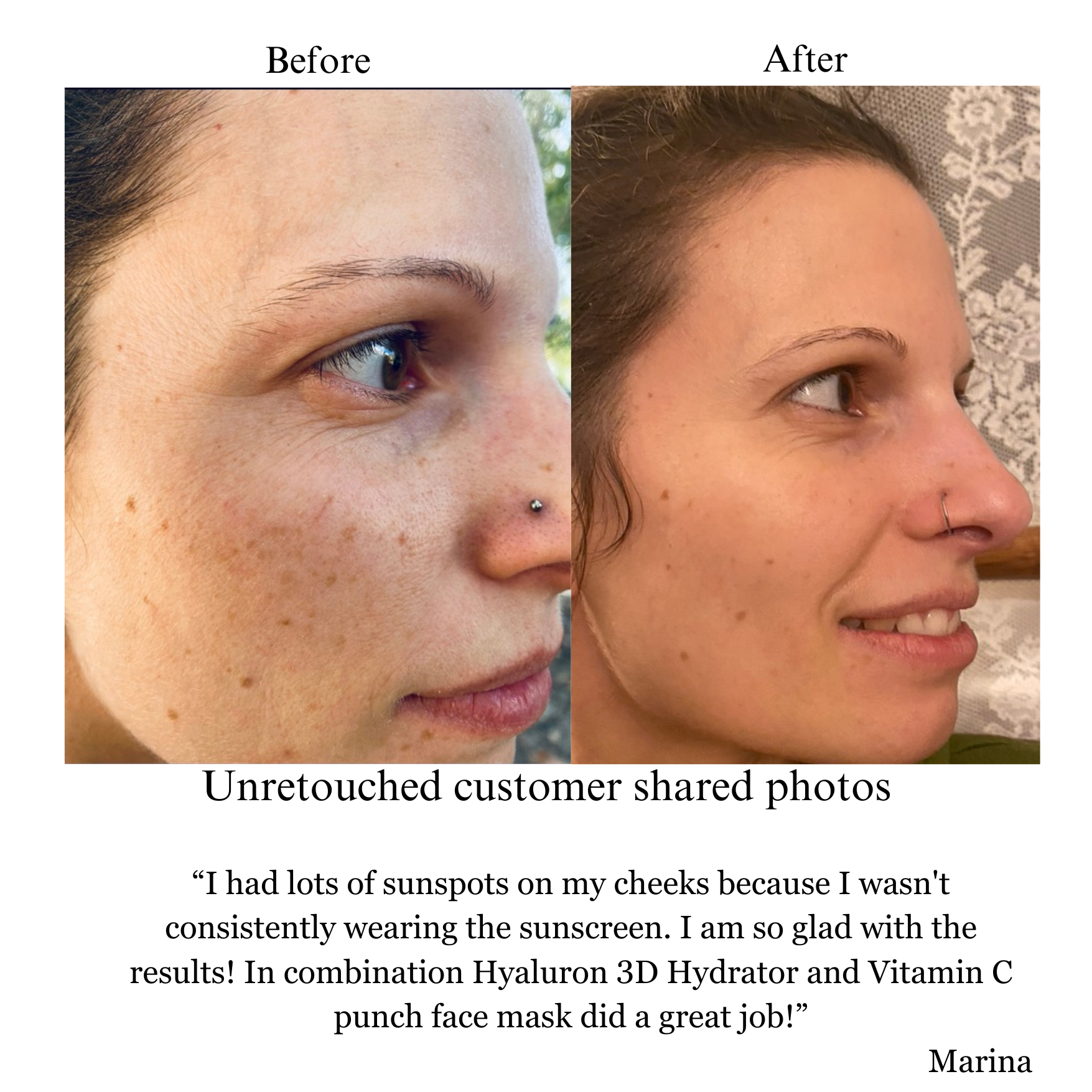 Hyaluron 3D Hydrator Multi Lamellar Emulsion The Advanced Response Face and Neck Cream-Serum