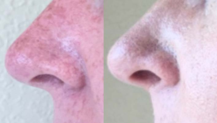 Lucent - Dramatic Brightening Potion