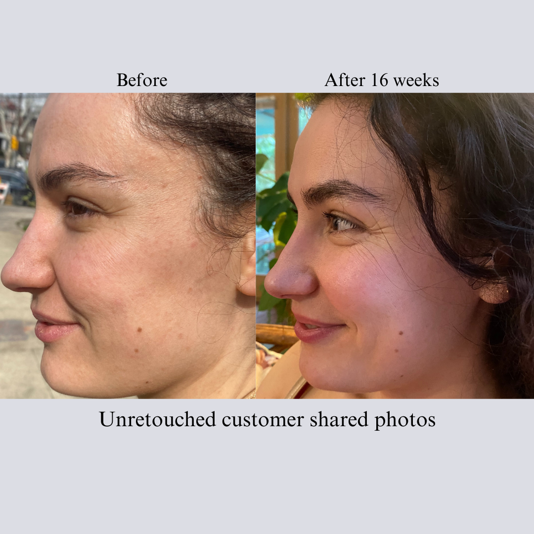 Hyaluron 3D Hydrator Multi Lamellar Emulsion The Advanced Response Face and Neck Cream-Serum