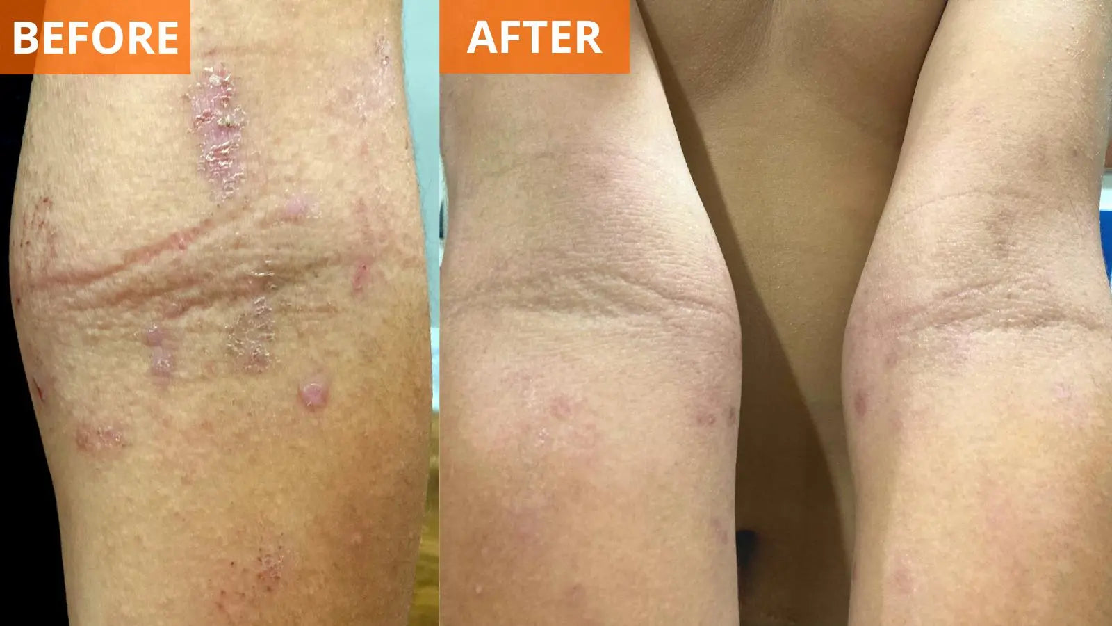 Moisturizing Body Lotion (Shopify Collective)