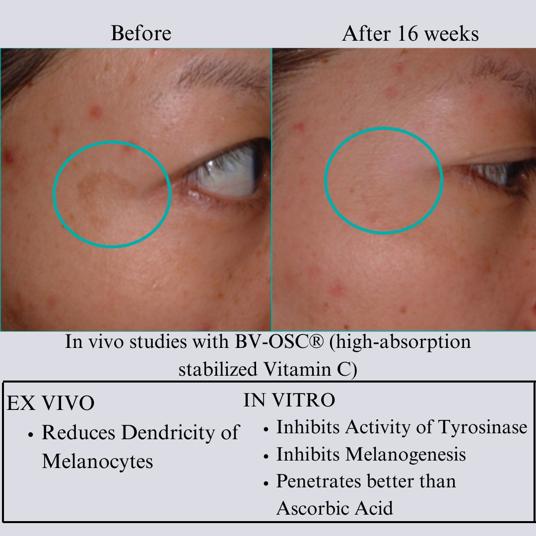 Hyaluron 3D Hydrator Multi Lamellar Emulsion The Advanced Response Face and Neck Cream-Serum