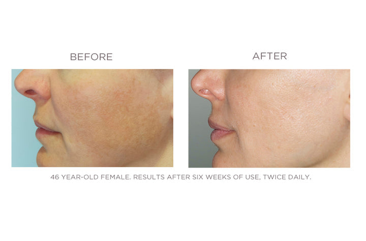 Lucent - Dramatic Brightening Potion