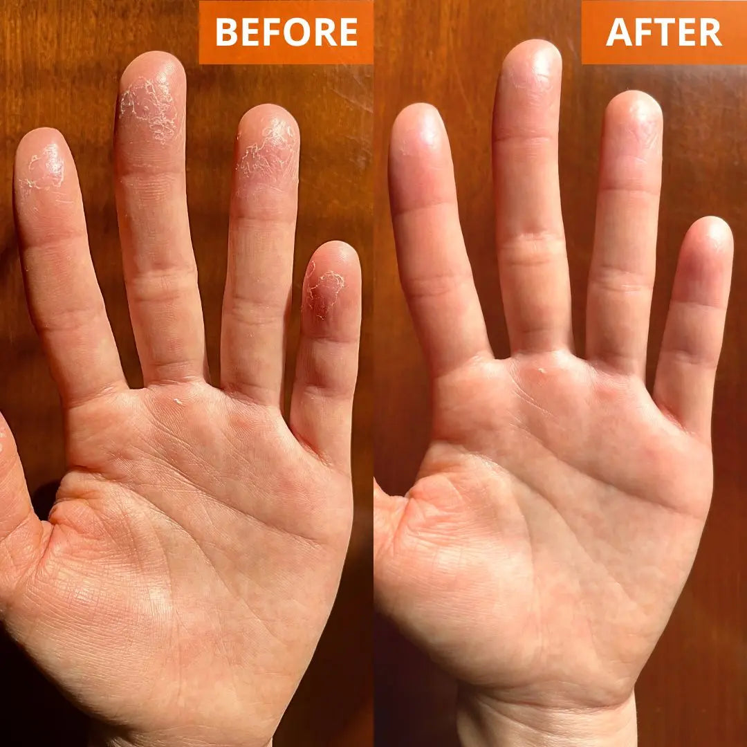 Moisturizing Skin Cream 4.4 Fl. Oz. Jar (Shopify Collective)