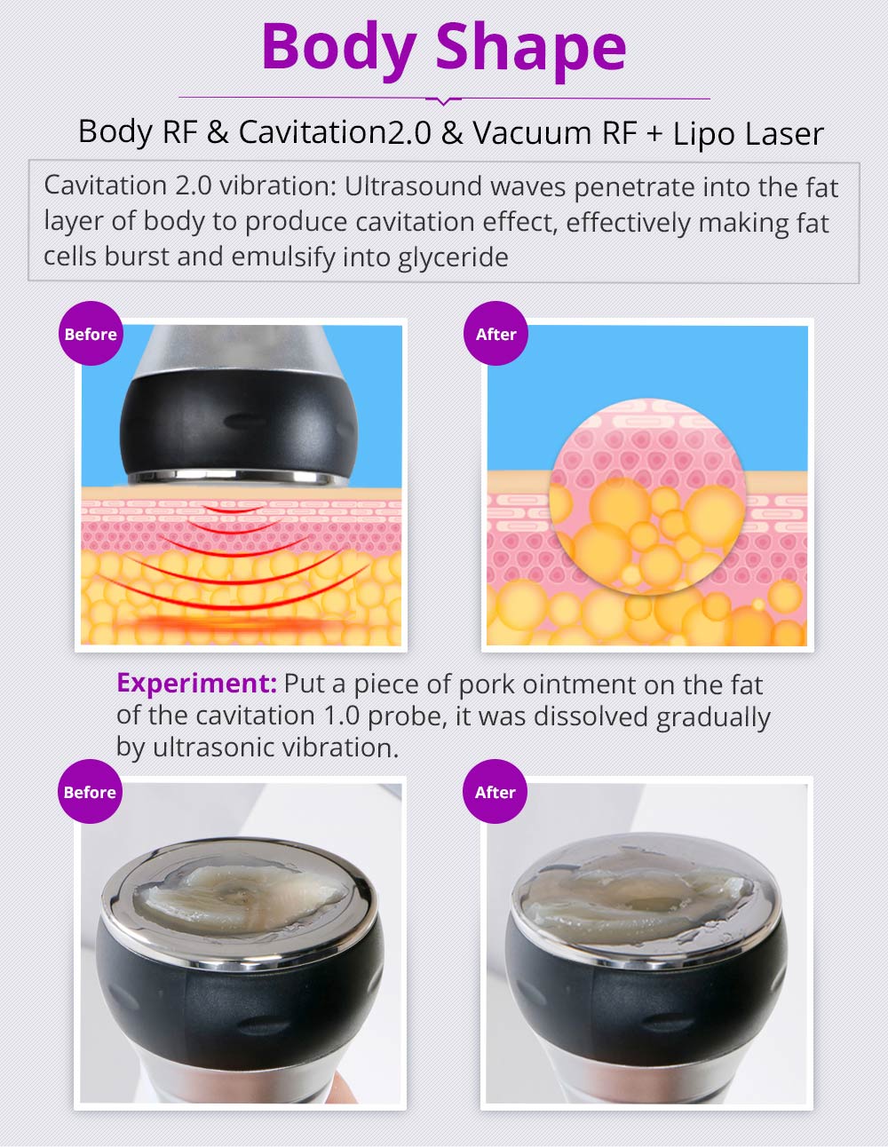 Kim 10 6-in-1 Cavitation RF Lipo Laser System