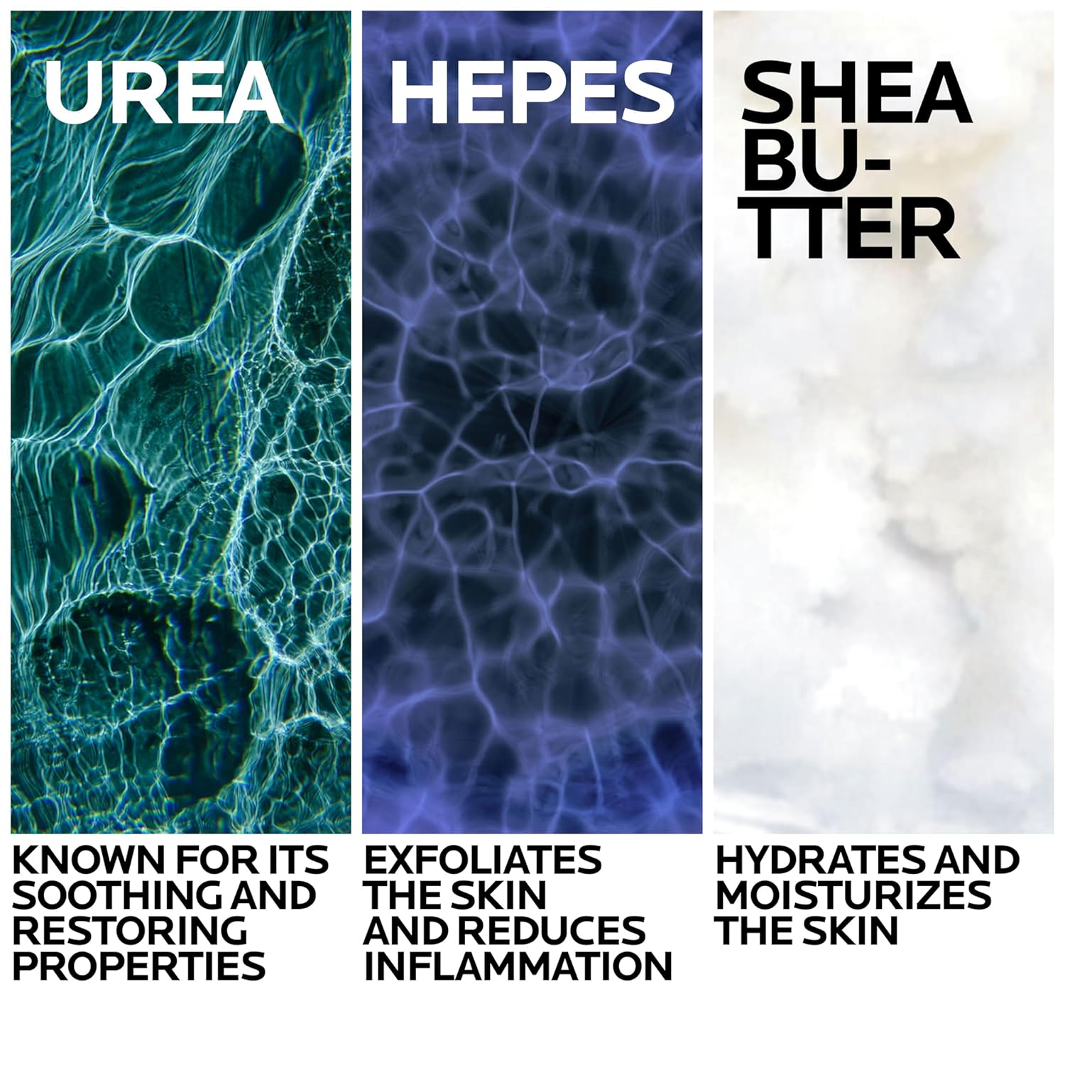 La Roche-Posay Lipikar Urea 10% Roughness Smoothing Lotion, Body Lotion For Dry Skin With 10% Urea + Shea Butter + Allantoin, Rough And Bumpy Skin Lotion, Softens & Smooths Skin With 1 Application