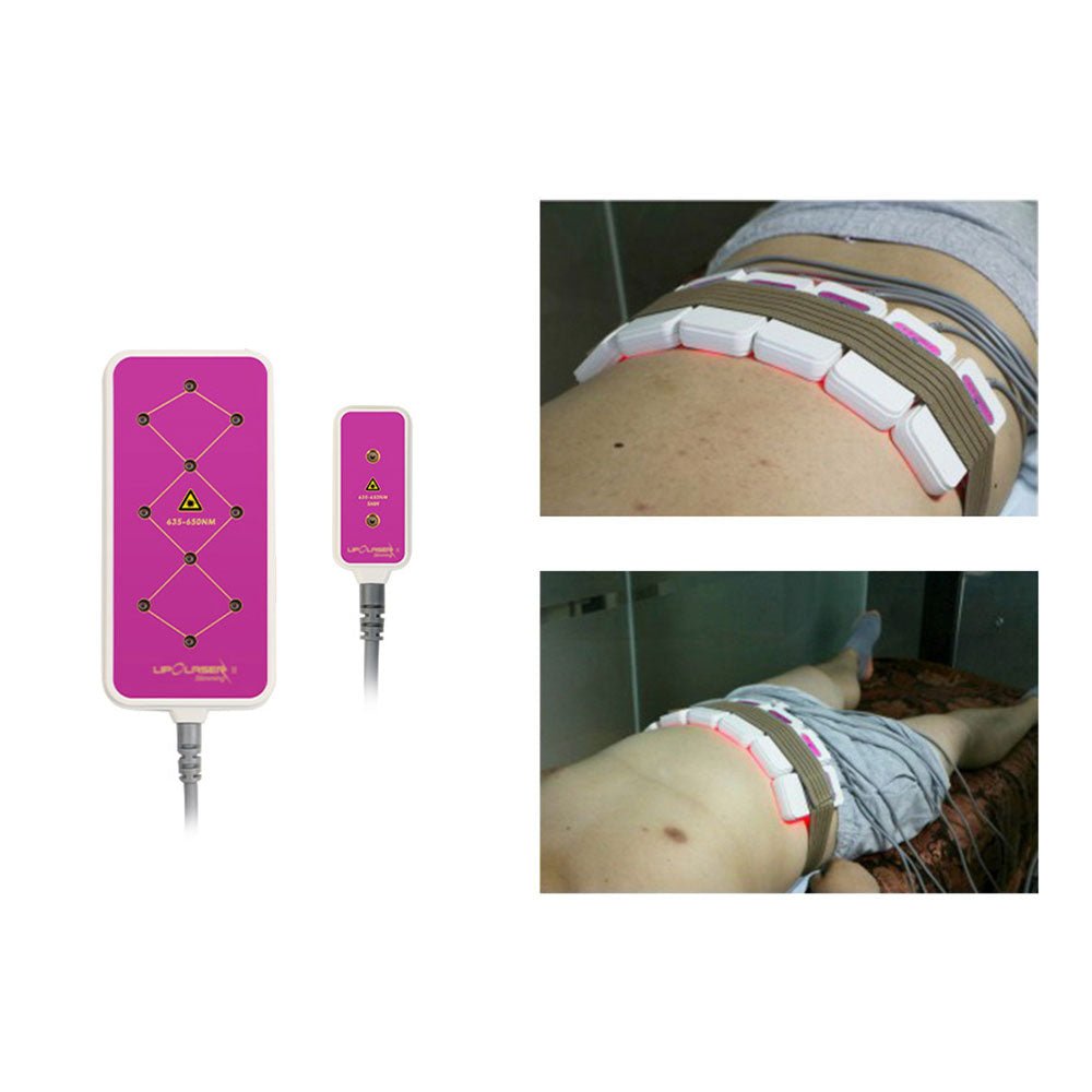 Shape Tactics 160mW LED Lipo Laser Body Contouring System