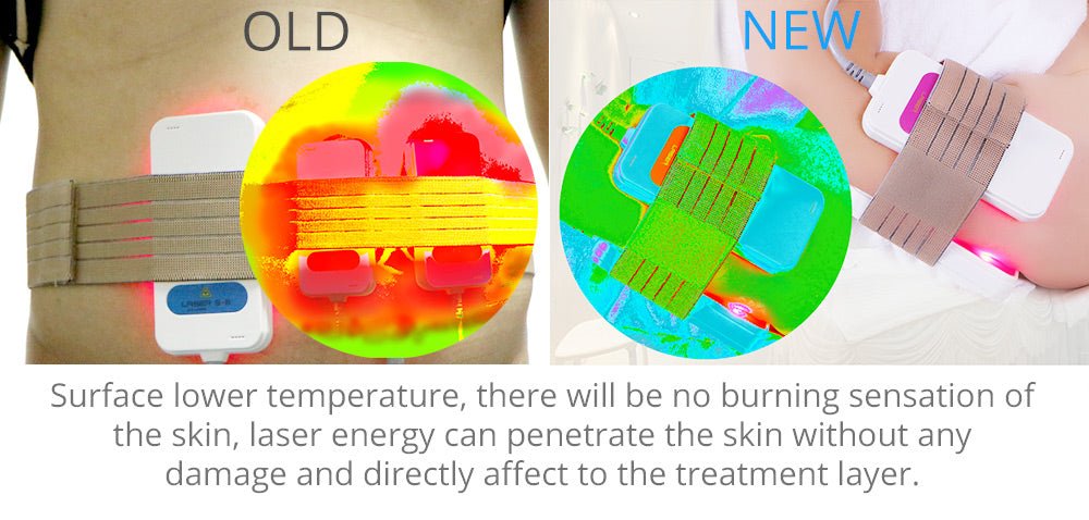 Shape Tactics 16-Pad 160mW Diode LED Lipo Laser Machine