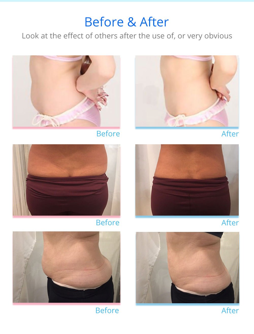 Shape Tactics 16-Pad 160mW Diode LED Lipo Laser Machine