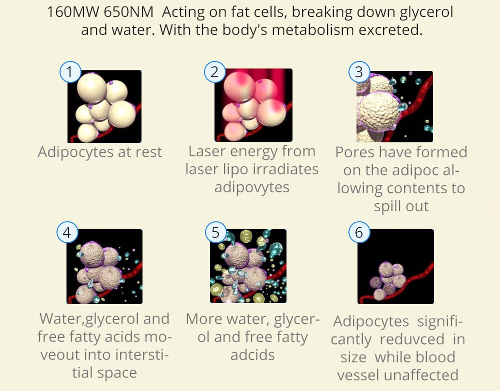 Shape Tactics 16-Pad 160mW Diode LED Lipo Laser Machine
