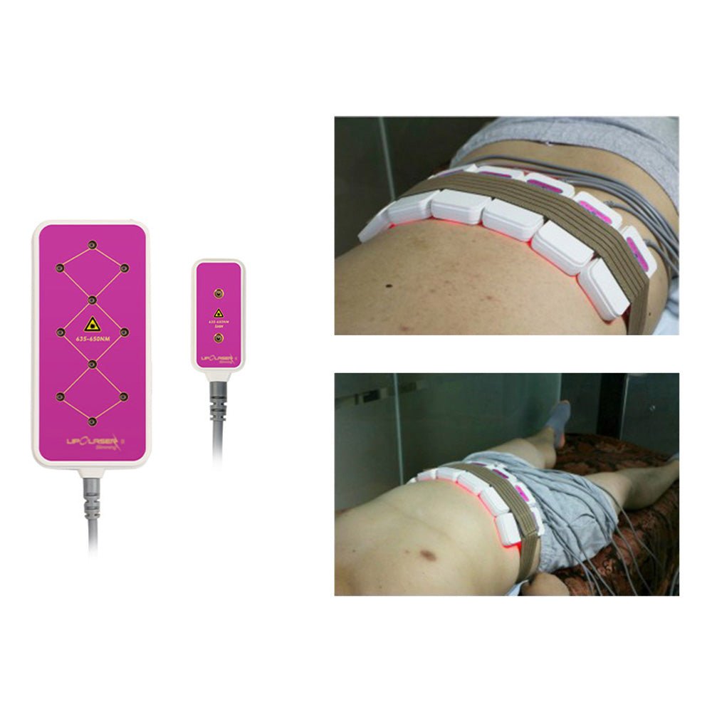 Shape Tactics 160mW 10-Pad Slimming Body System