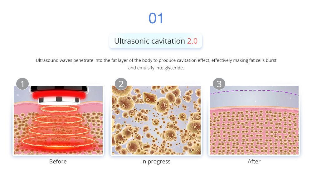 Shape Tactics 4-in-1 Cryolipolysis Cavitation RF Body Contouring System