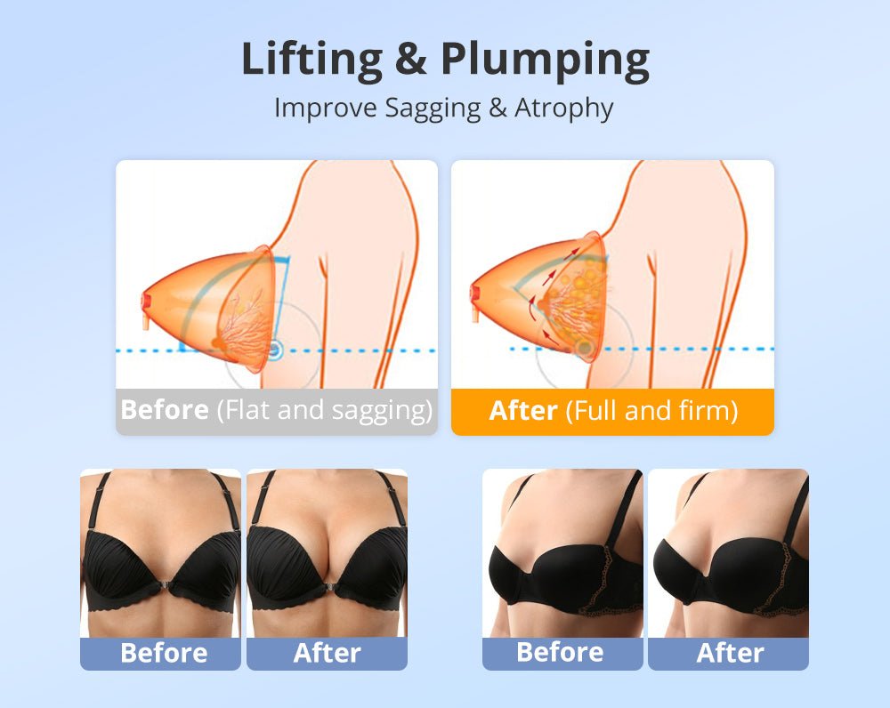 Shape Tactics 40K Cavitation and RF Vacuum Contouring System