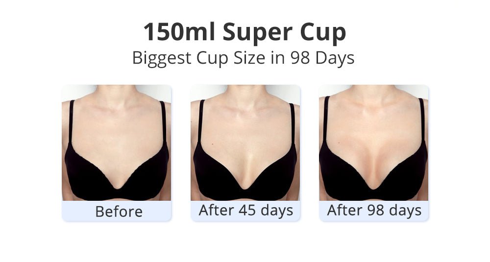 Shape Tactics 40K Cavitation and RF Vacuum Contouring System