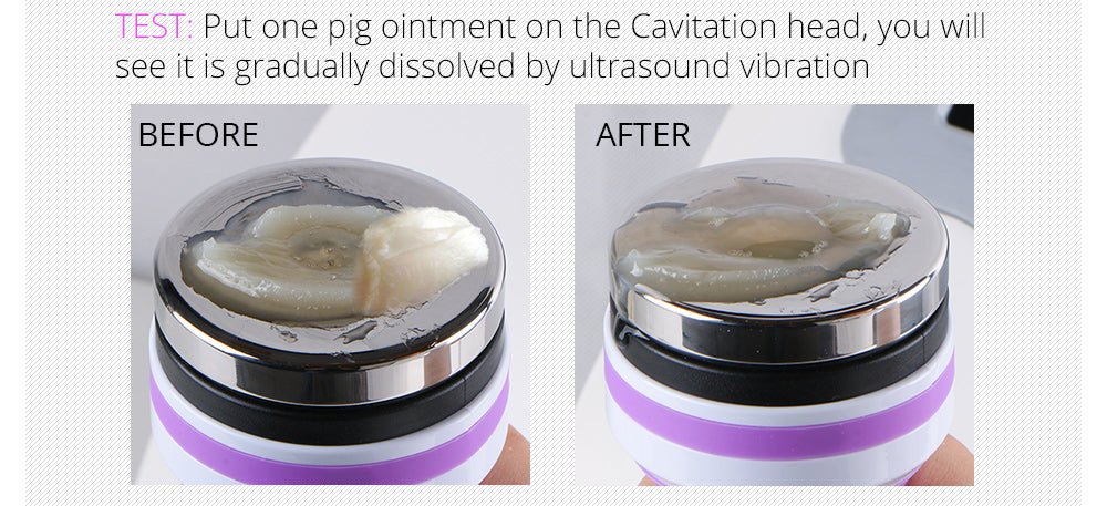 Shape Tactics 5-in-1 RF Cavitation Body Contouring System