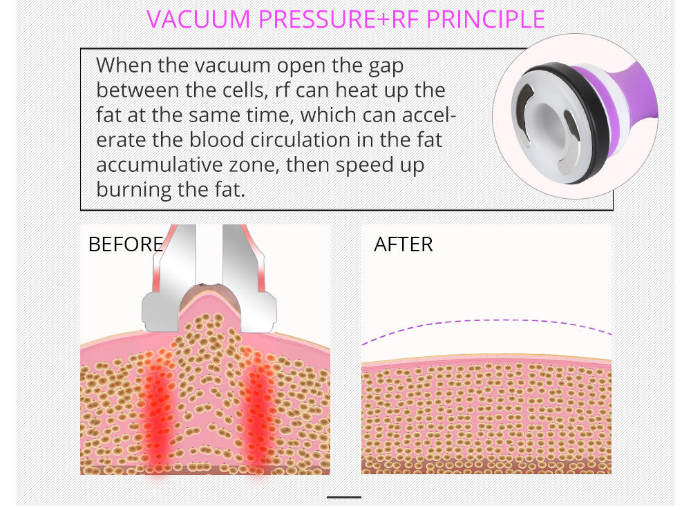 Shape Tactics 5-in-1 RF Cavitation Body Contouring System