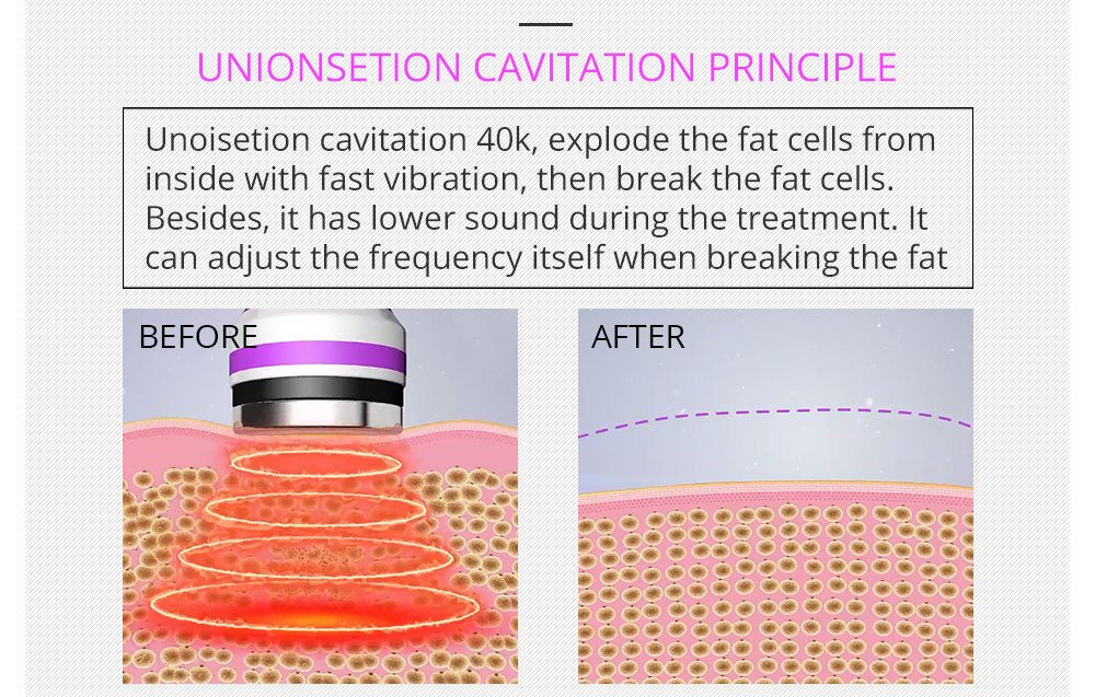 Shape Tactics 5-in-1 RF Cavitation Body Contouring System