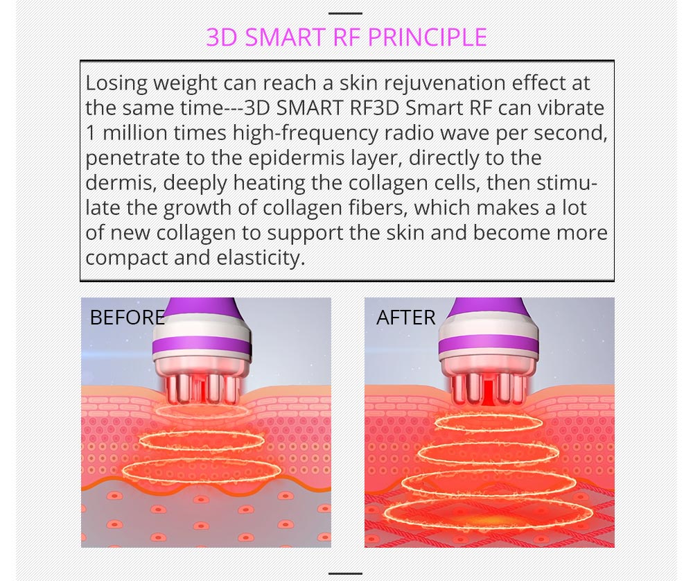 Shape Tactics 5-in-1 RF Cavitation Body Contouring System