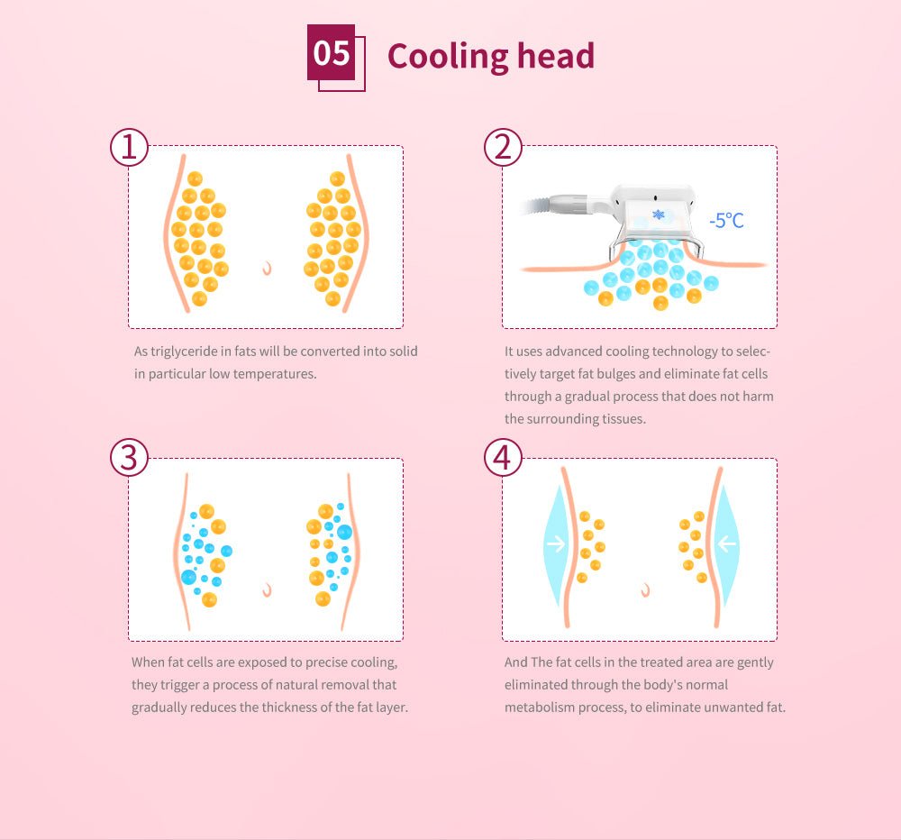 Shape Tactics 5-in-1 Cryolipolysis Vacuum RF Cooling System