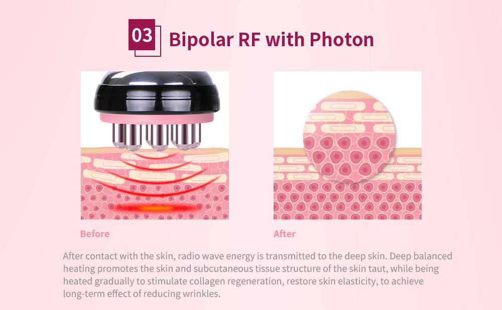 Shape Tactics 5-in-1 Cryolipolysis Vacuum RF Cooling System