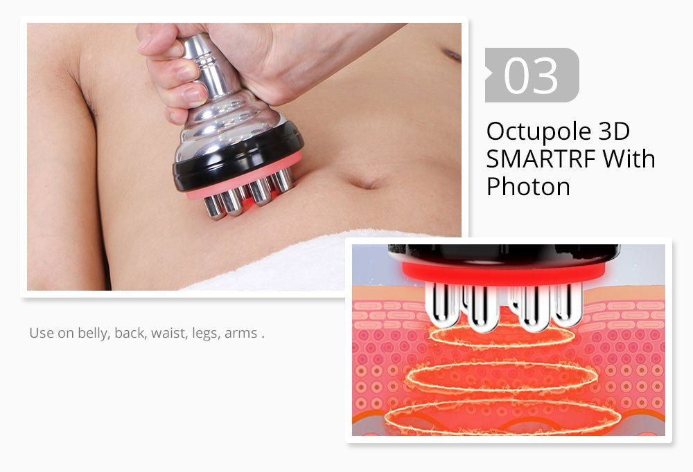 Shape Tactics 5-in-1 Unoisetion Cavitation 2.0 3D Smart Vacuum RF System