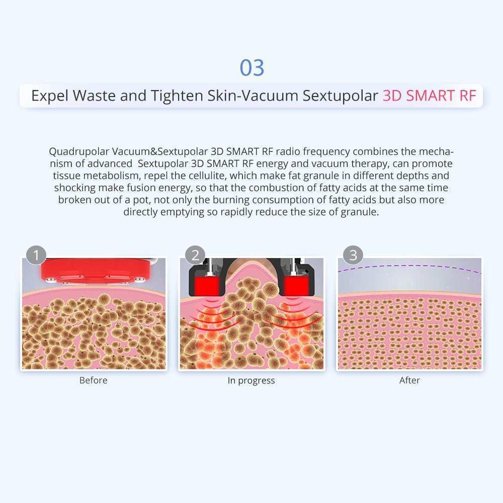 Shape Tactics 5-in-1 Unoisetion Vacuum RF System