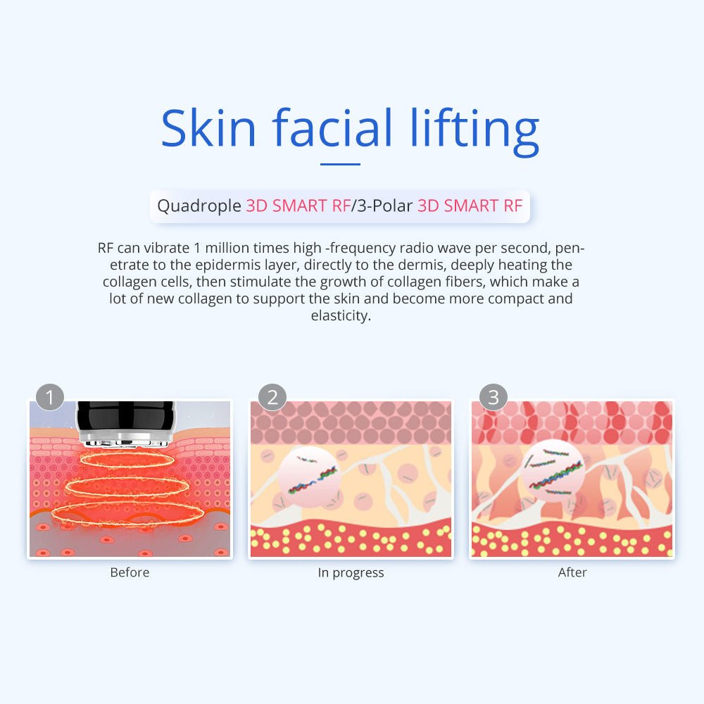 Shape Tactics 5-in-1 Unoisetion Vacuum RF System