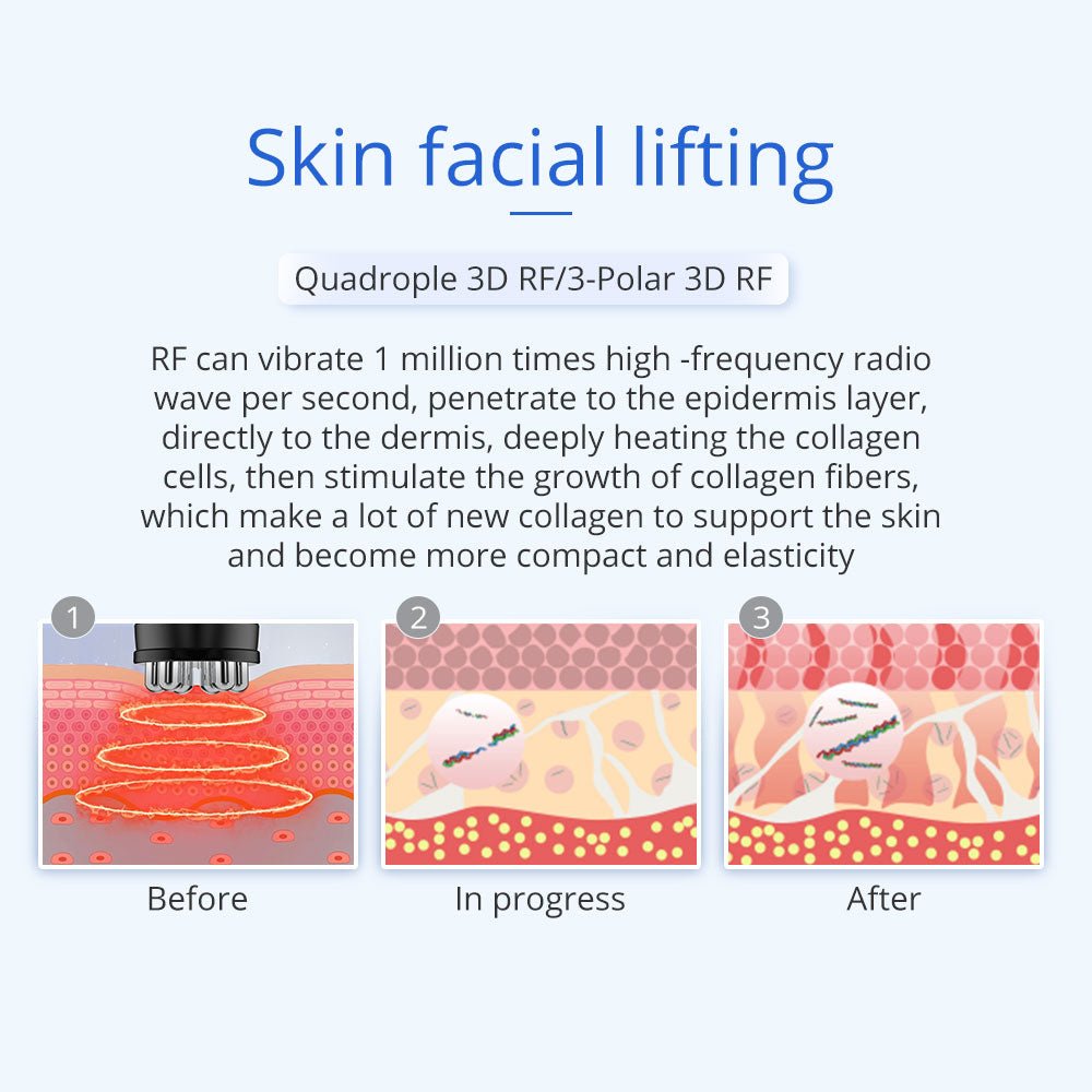 Shape Tactics 5-in-1 Unoisetion Ultrasonic RF Cavitation System
