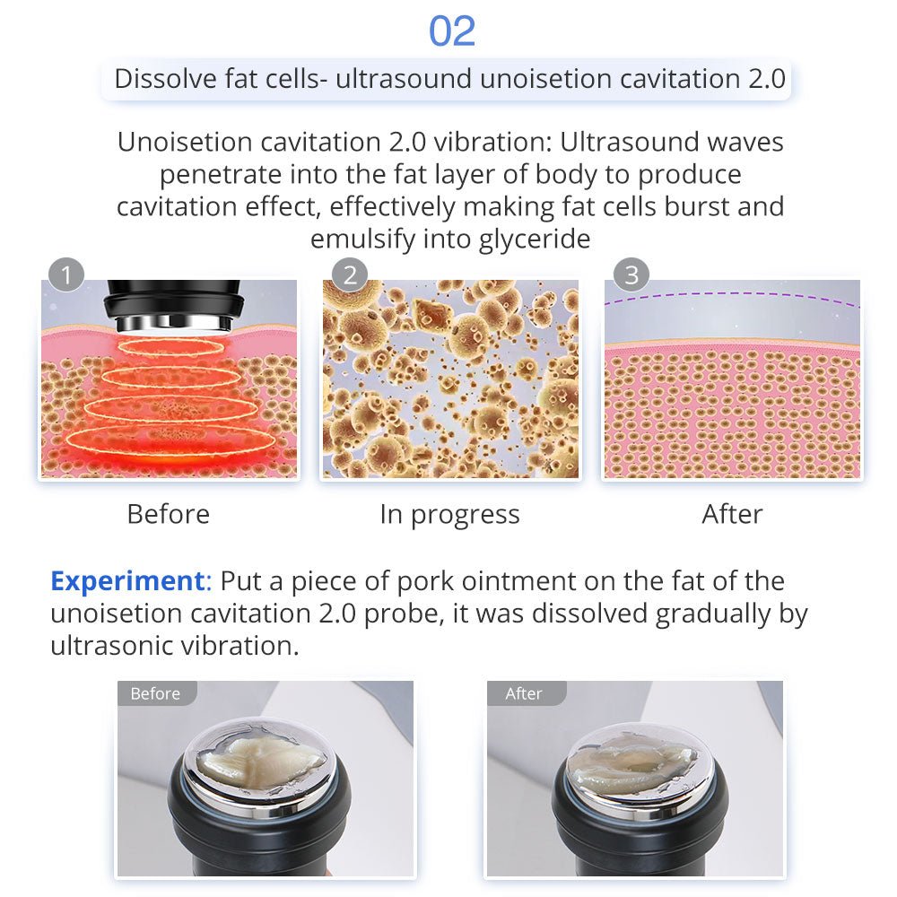 Shape Tactics 5-in-1 Unoisetion Ultrasonic RF Cavitation System