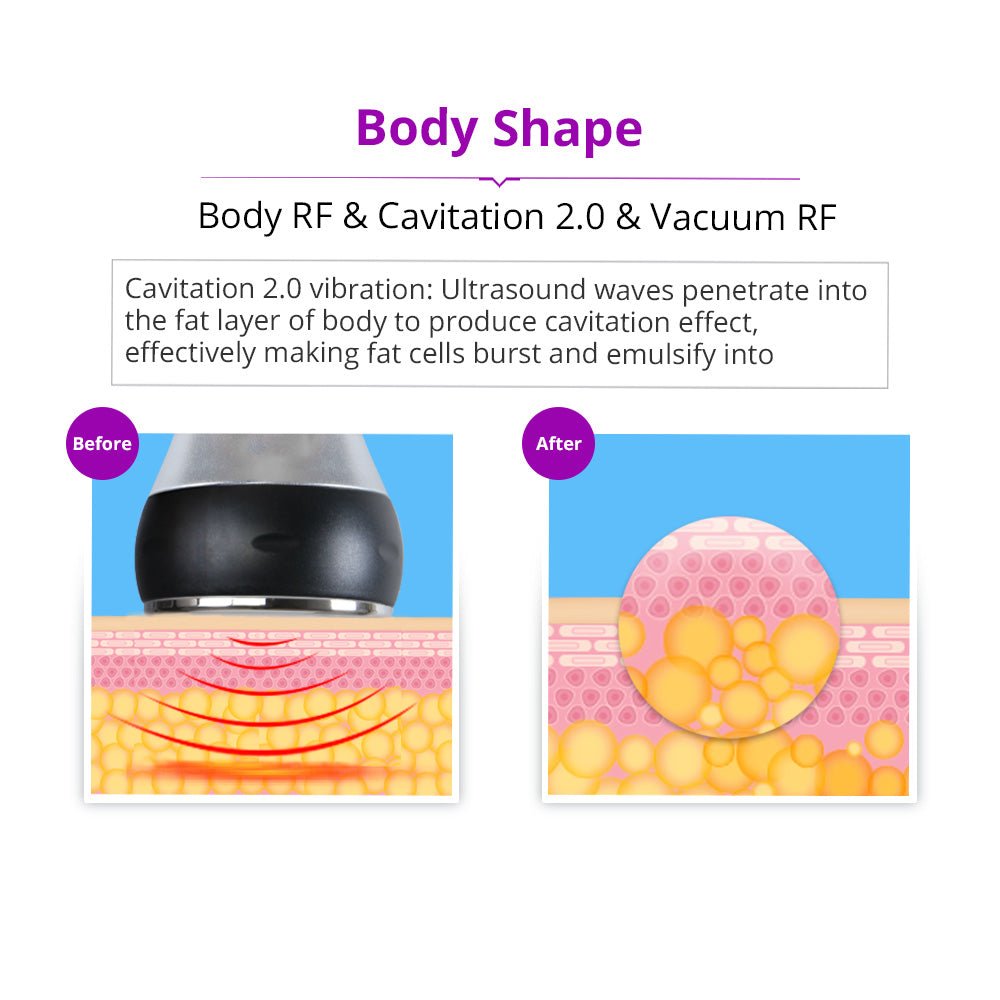 Shape Tactics 5-in-1 Cavitation RF Vacuum Body Contouring System
