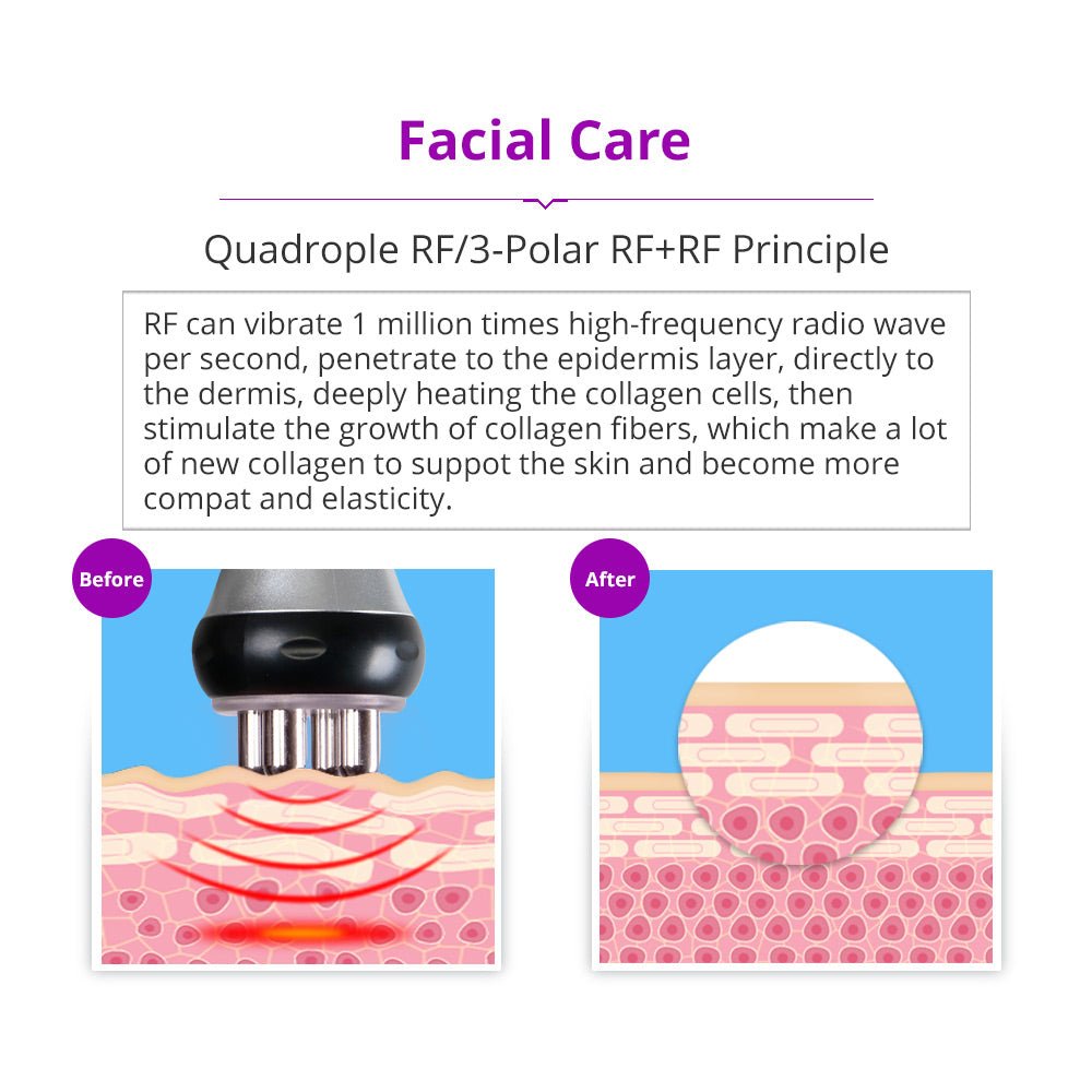 Shape Tactics 5-in-1 Cavitation RF Vacuum Body Contouring System