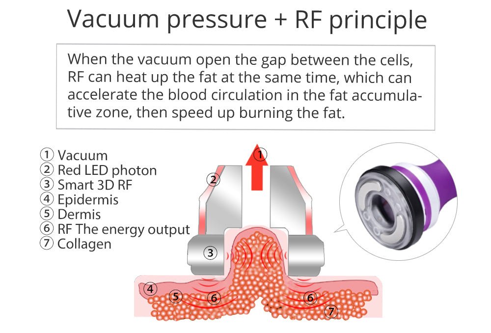 Shape Tactics 5-in-1 RF Cavitation Wellness System