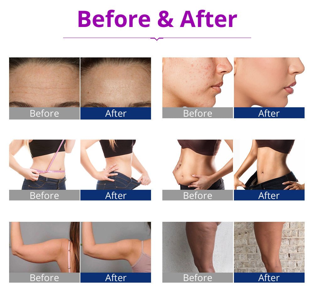 Shape Tactics 5-in-1 RF Cavitation Wellness System
