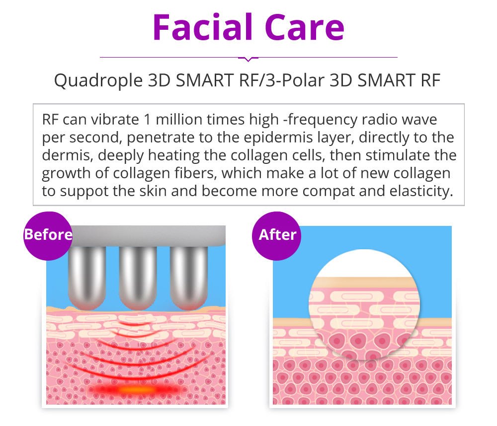 Shape Tactics 5-in-1 RF Cavitation Wellness System