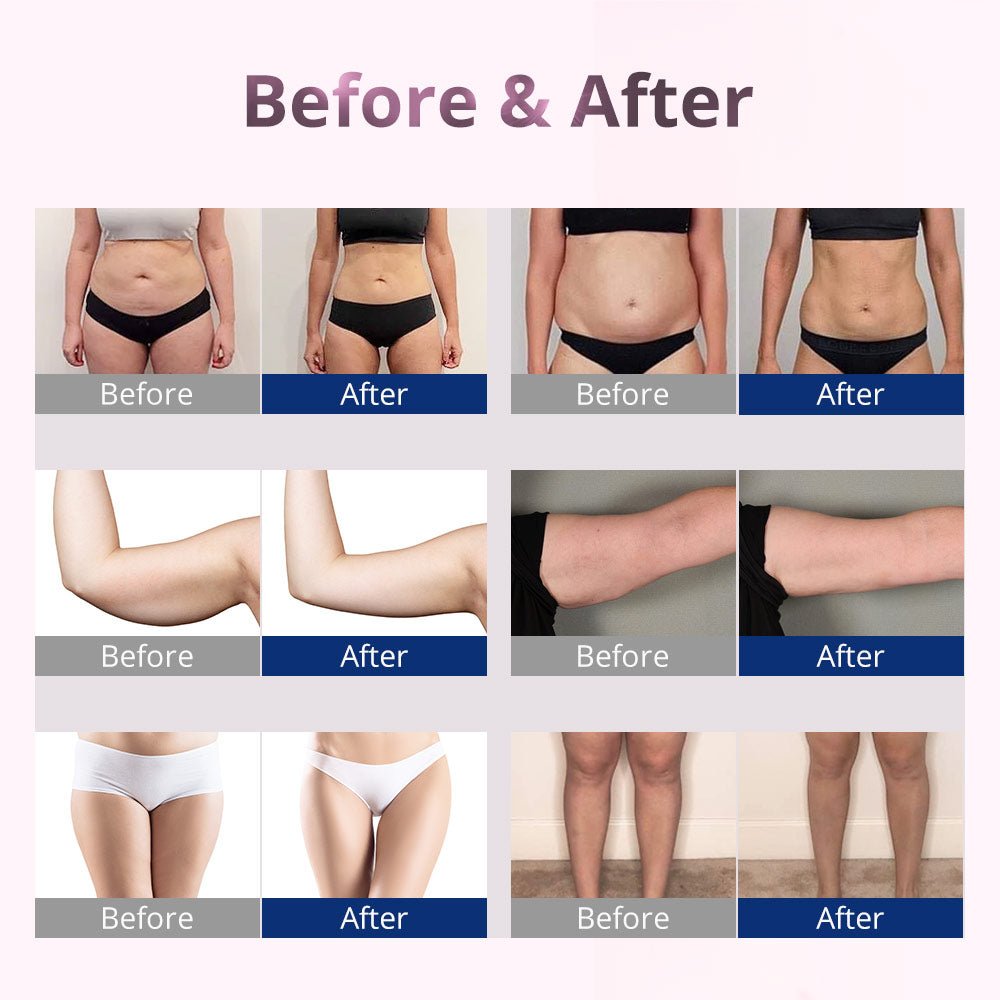 Shape Tactics 10-Pad LED Laser Therapy System 635-650nm