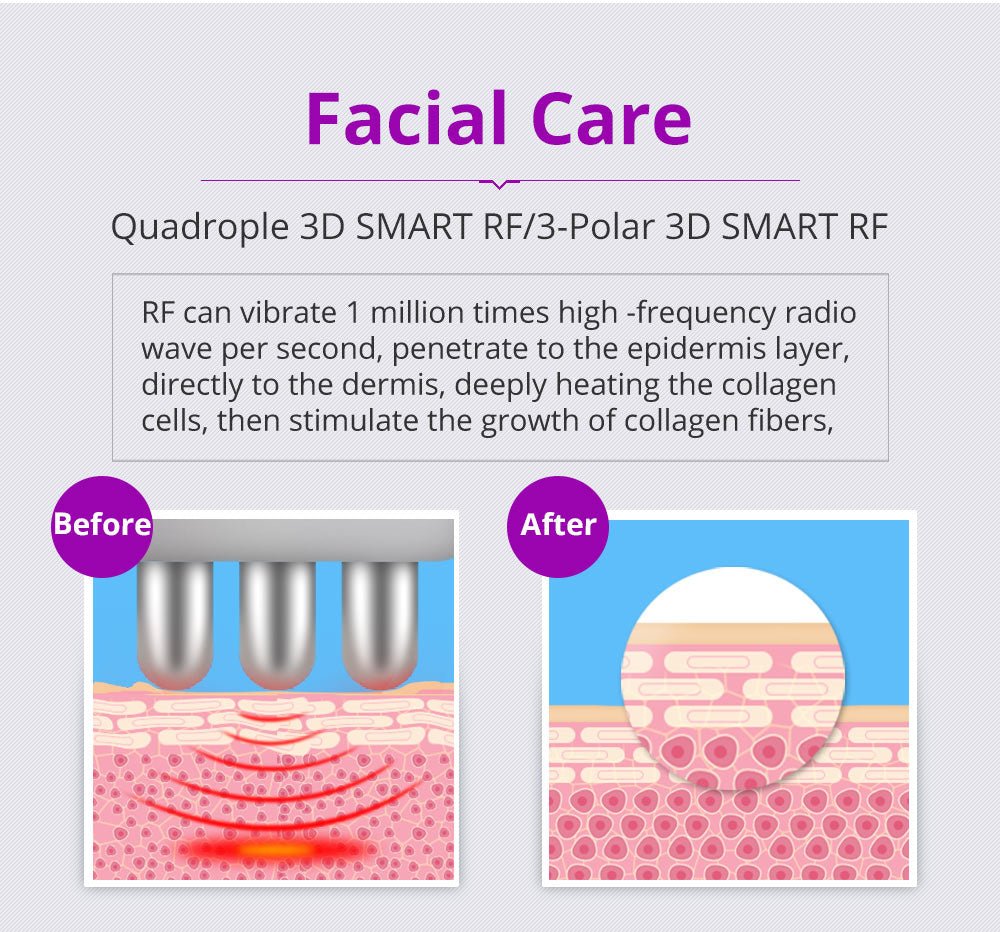 Shape Tactics 6-in-1 40K LED RF Wellness System