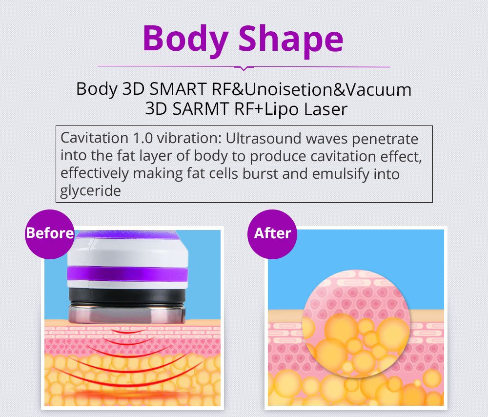 Shape Tactics 6-in-1 40K LED RF Wellness System