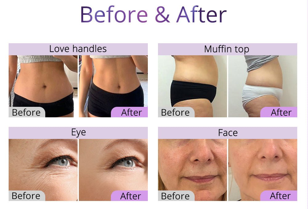 Shape Tactics 6-in-1 Ultrasonic RF Lipo Laser Contouring System