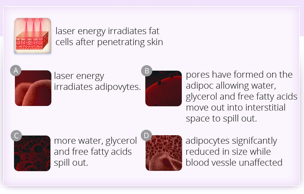Shape Tactics 6-in-1 Ultrasonic RF Lipo Laser Contouring System