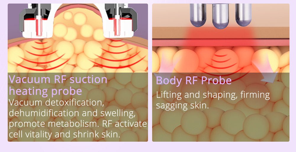 Shape Tactics 6-in-1 Ultrasonic RF Lipo Laser Contouring System