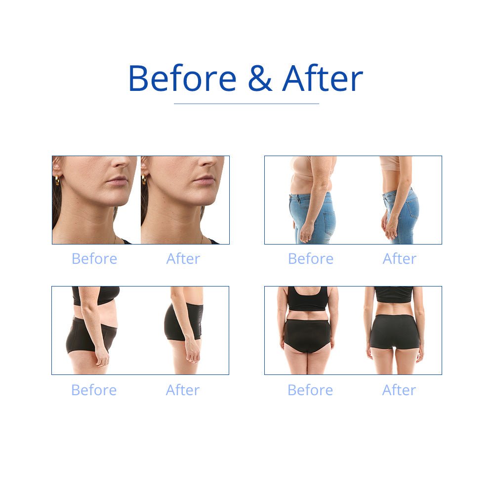 Shape Tactics 6-in-1 Cavitation RF Cryolipolysis Lipo Laser System