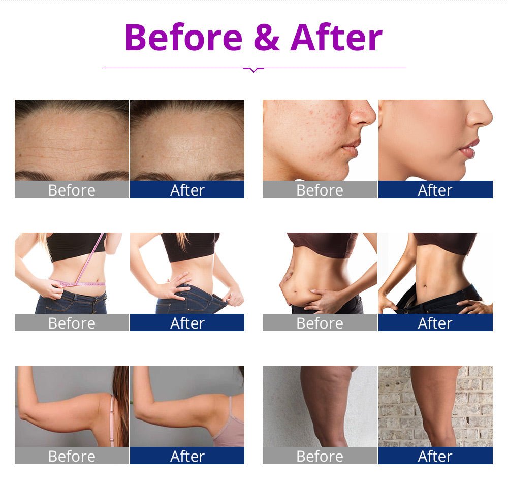 Shape Tactics 6-in-1 Cavitation RF LED Laser Lipo System
